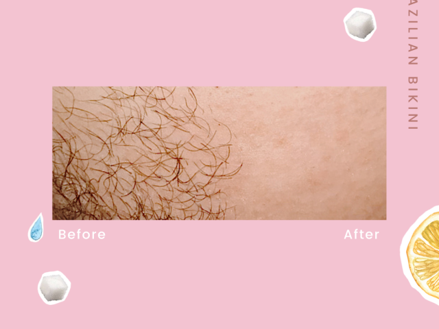 Does sugaring hurt less than waxing?