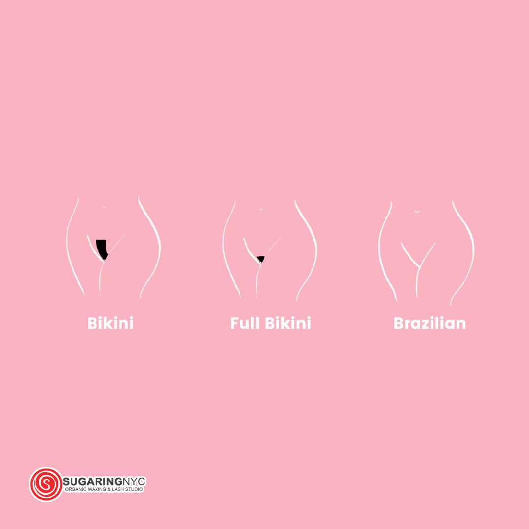 Bikini - Full (Brazilian) - Laser Hair Removal NYC