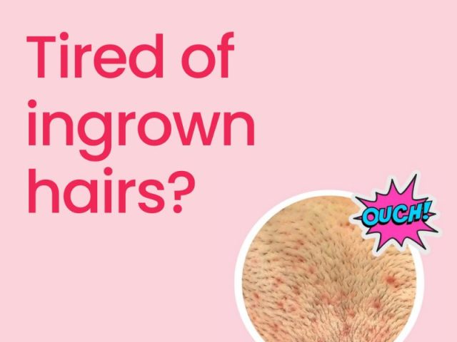 Outsmarting Ingrown Hairs: Why a Multi-Step Routine is Your Secret Weapon