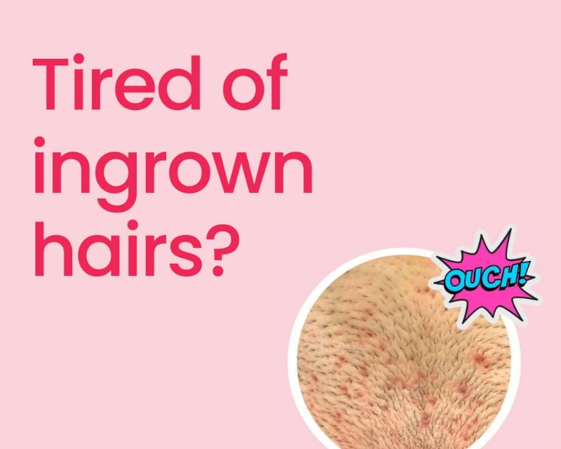 Outsmarting Ingrown Hairs: Why a Multi-Step Routine is Your Secret Weapon