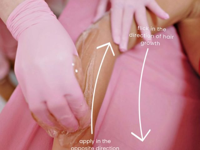 Say Goodbye to Ingrown Hairs!