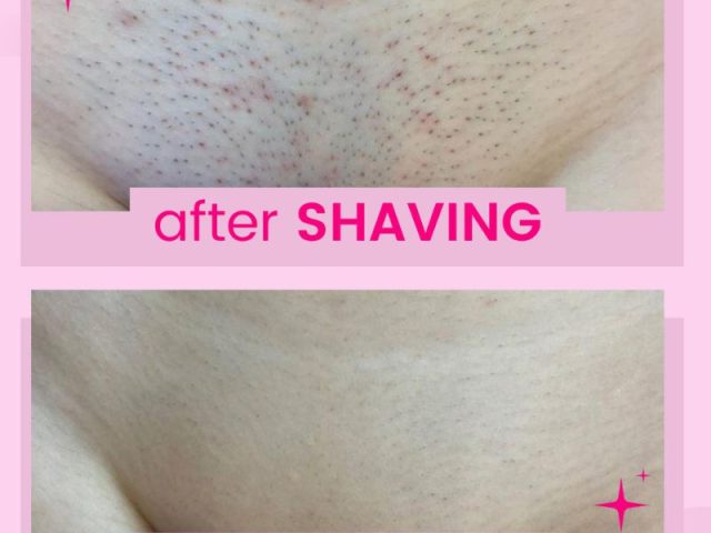 Get Smoother Skin with Sugaring: Say Goodbye to Stubble!