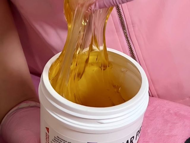 Why Does Sugaring Prevent Ingrown Hairs?