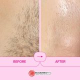 Experience Smooth, Redness-Free Skin with Brazilian Sugaring from SugaringNYC!