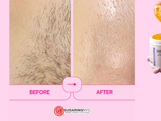 Sugaring vs. Shaving: What You Should Know