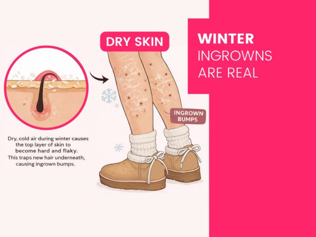 Ingrown Hairs: What Causes Them and How Sugaring Helps Prevent Them!