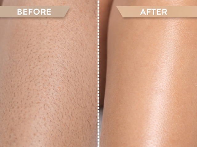 Why Consistency in Sugaring Is So Important?